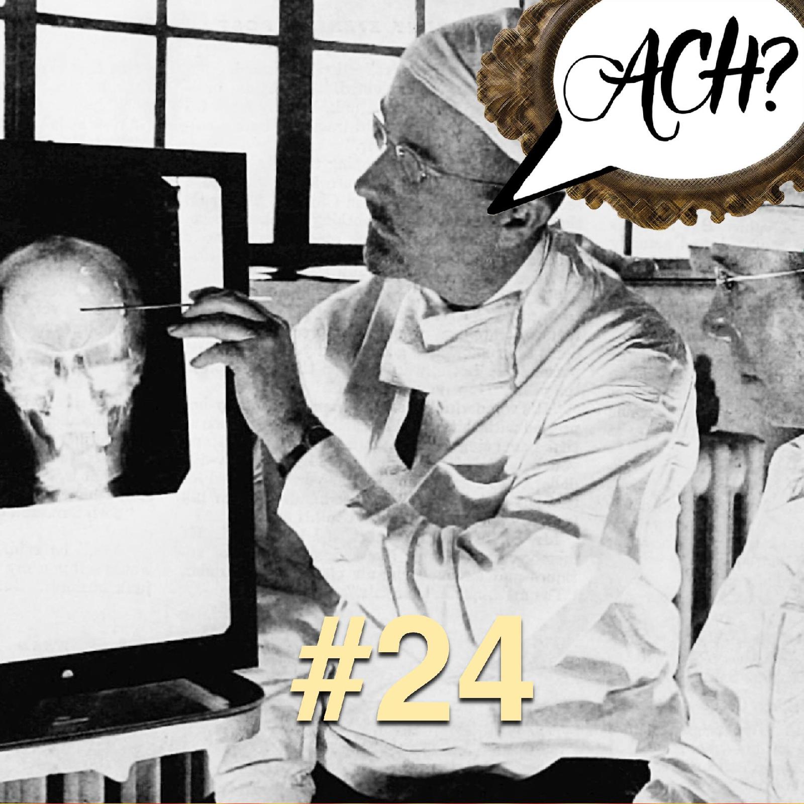 Ach-Podcast: 24 – Lobotomie: viel Spaß fürs Hirn für wenig Geld